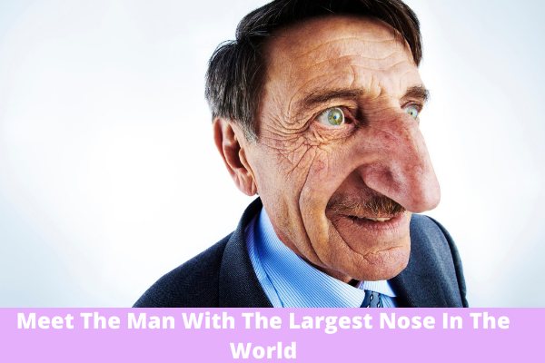 Meet The Man With The Largest Nose In The World