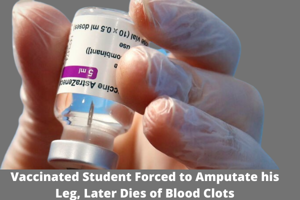 Vaccinated Student Forced to Amputate his Leg, Later Dies of Blood Clots