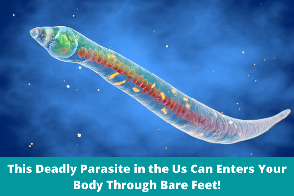 This Deadly Parasite in the Us Can Enters Your Body Through Bare Feet!
